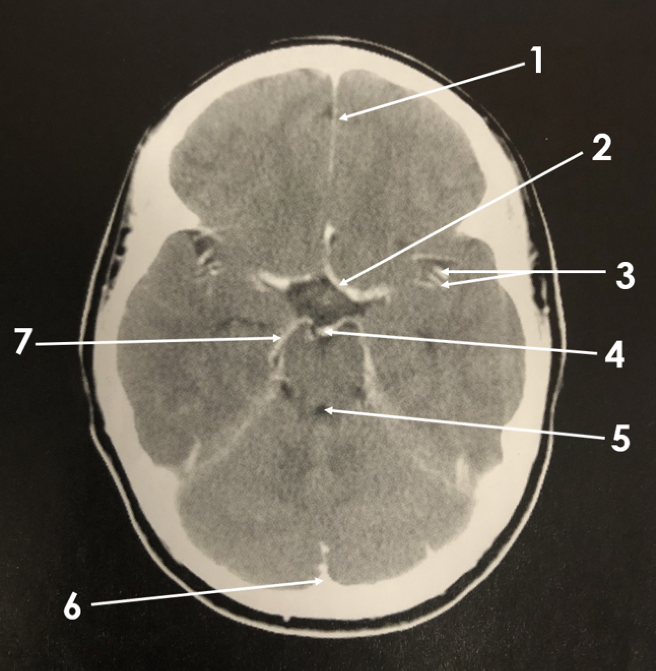 <p>7</p>