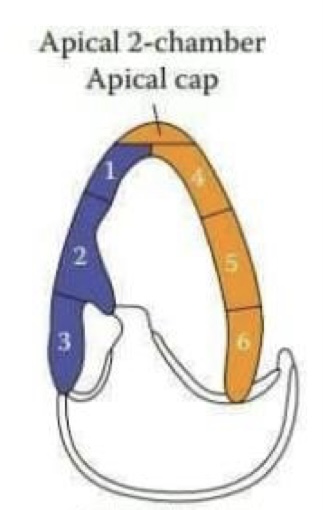 <ol><li><p>Apical inferior (RCA)</p></li><li><p>Mid inferior (RCA)</p></li><li><p>Basal inferior (RCA)</p></li><li><p>Apical anterior (LAD)</p></li><li><p>Mid anterior (LAD)</p></li><li><p>Basal anterior (LAD)</p></li></ol>