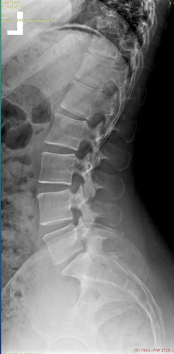 <p>What projection view is this?</p>