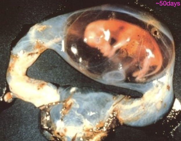 <p>-abortion may result from an event that occurred weeks to months earlier</p><p>-the fetus is often retained in the uterus for hours or days after death and autolysis obscures diagnostic lesions</p><p>-incomplete diagnostic specimens available/submitted</p>