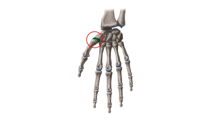 <p>Trapeziometacarpal</p>