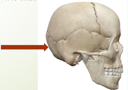 <p>what bone is the arrow pointing to?</p>