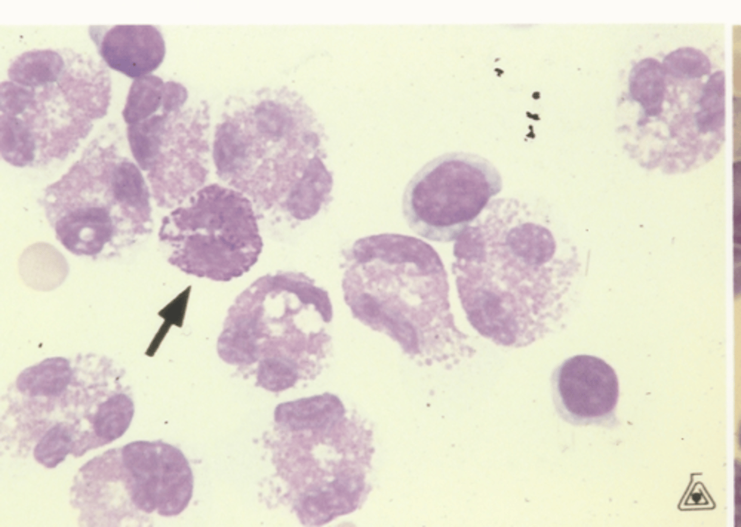 <p>Identify the cells in this body fluid</p>
