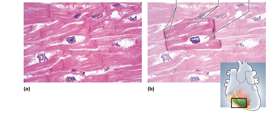 <p>location of cardiac muscle</p>