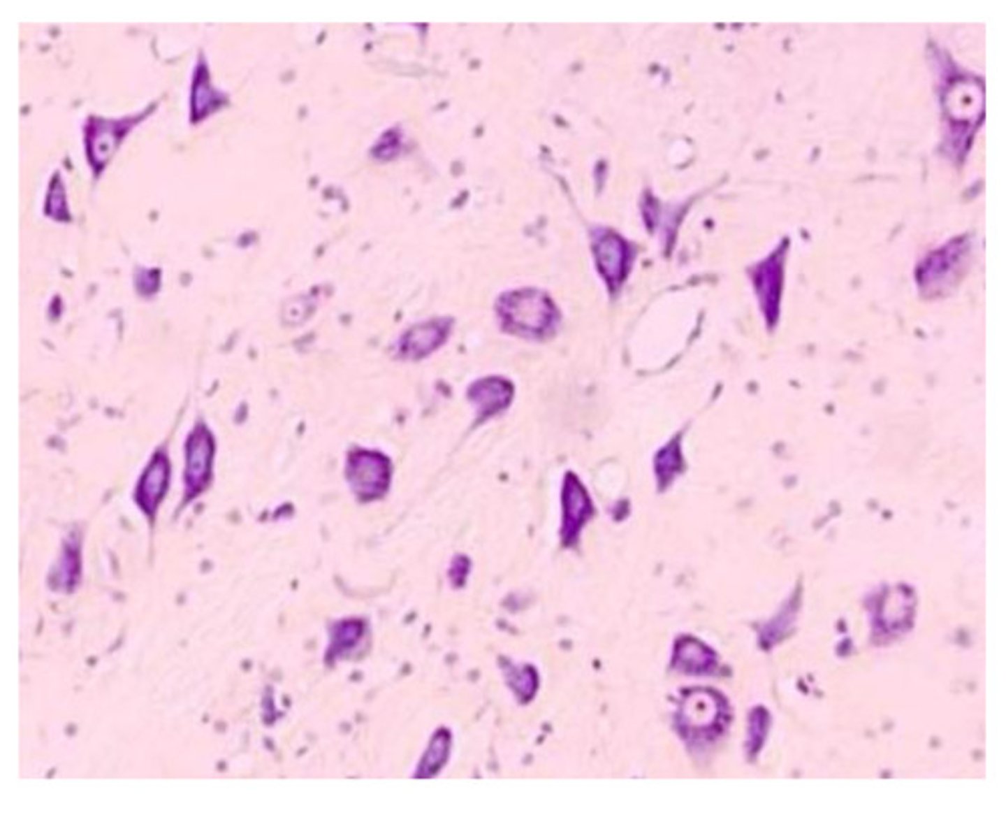 <p>-appears purple</p><p>-Stains nucleic acids (RNA, DNA) and nissel bodies. -Good for distinguishing neurons from glial cells</p>
