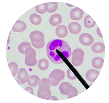 <p>what kind of white blood cells is this?</p>