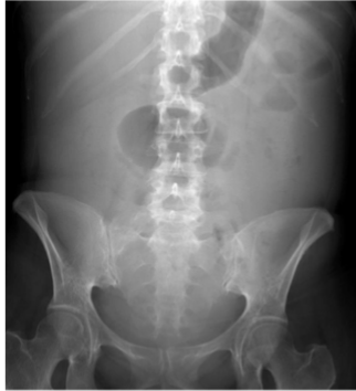 <p>What is this and what type of scan </p>