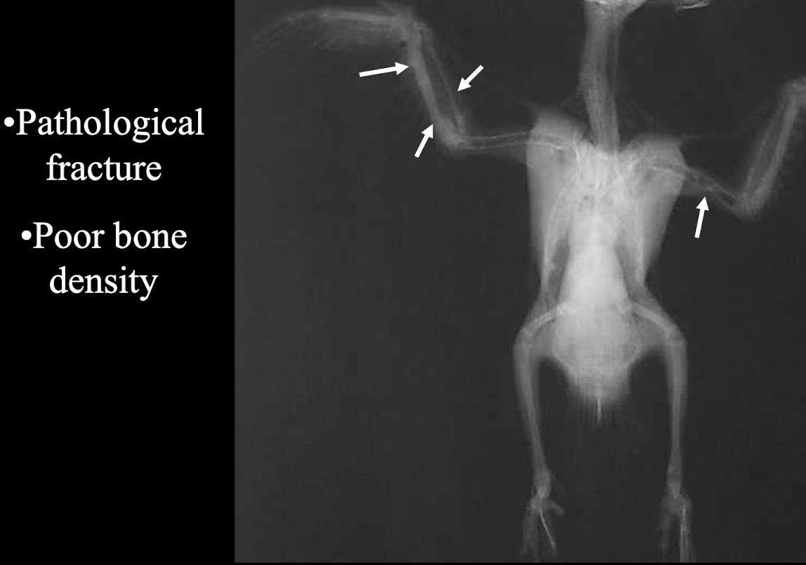 <p>Pathological fracture and poor bone density.</p>