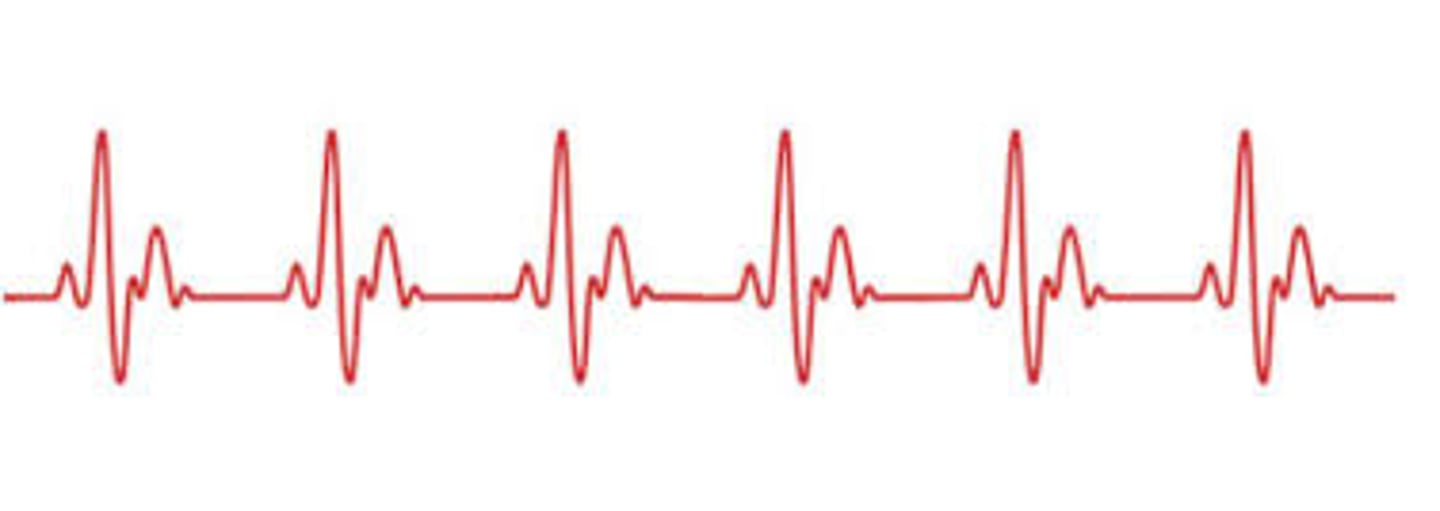 <p>frequently</p>