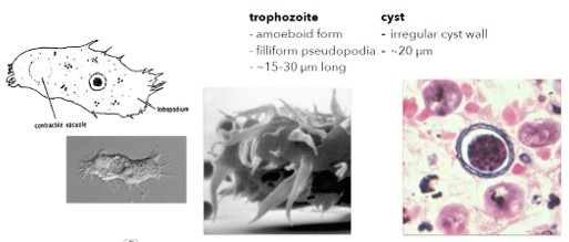 <ul><li><p>disease caused, pathogenicity, transmission (multiple possible sources of infection), normal habitat. </p><ul><li><p>Acanthamoeba keratitis (AK); ulceration of cornea; hot tubs and contaminated contact lens fluid; topical antibiotics; commonly found in lakes, swimming pools, tap water, and heating and air conditioning units</p></li></ul></li></ul><p></p>