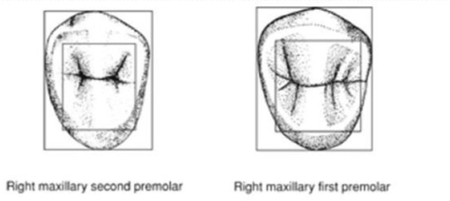 <p>Coronal tooth dimensions considerably __ faciolingual than mesiodistal</p>