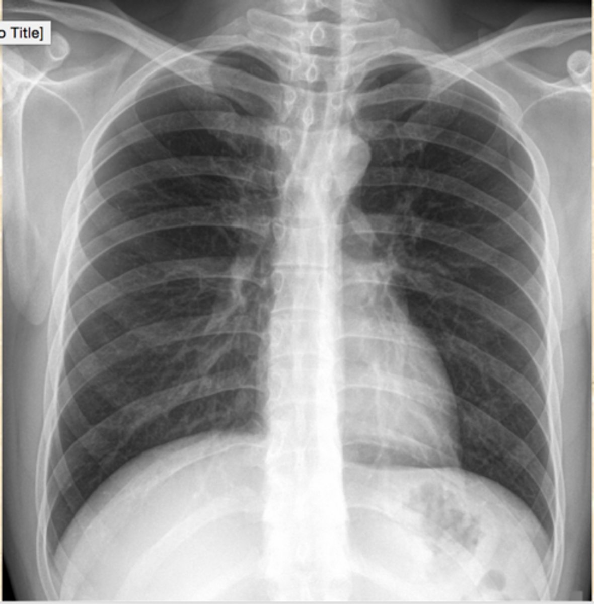 <p>Diagnosis?</p>