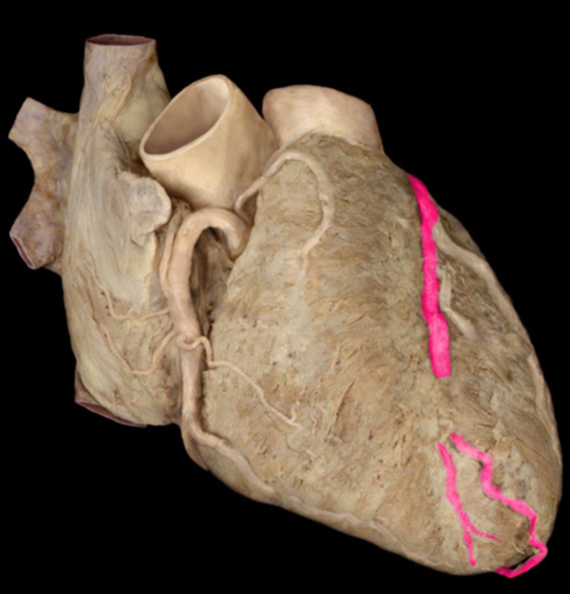 <p>artery</p>