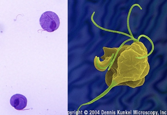 <p>Genus: Trichomonas</p>