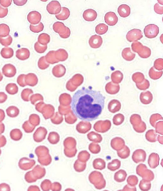 <p><strong>agranular leukocytes: monocytes</strong></p><ul><li><p>U-shaped nuclei</p></li><li><p>life span: < 3 days in blood, months in tissues</p></li><li><p>_____ in tissues</p><ul><li><p>fixed or wandering</p></li></ul></li><li><p>_____ (skin, mucosa)</p><ul><li><p>antigen presenting cells</p><ul><li><p>innate → adaptive</p></li></ul></li></ul></li><li><p>~10% of WBCs</p></li></ul><p></p>