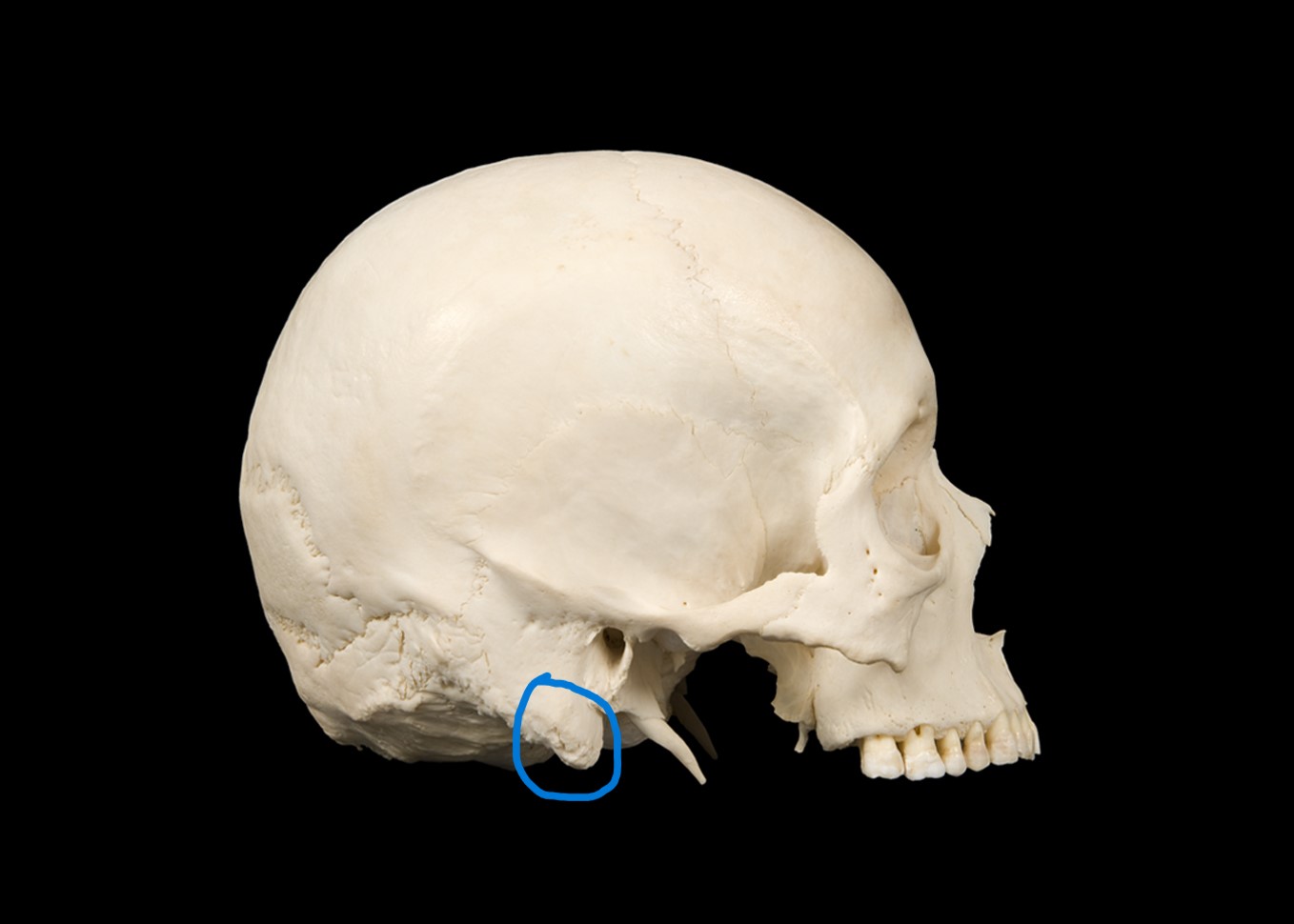 term image