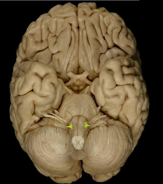 <p>List the nerve name, roman numeral, and function.</p>