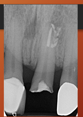 <p>Mach bands in this image?</p>