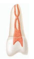 <p><span><strong><span>One canal leaves the pulp chamber, divides and then rejoins in the body of the root, and finally redivides into two distinct canals short of the apex (1-2-1-2).</span></strong></span></p>