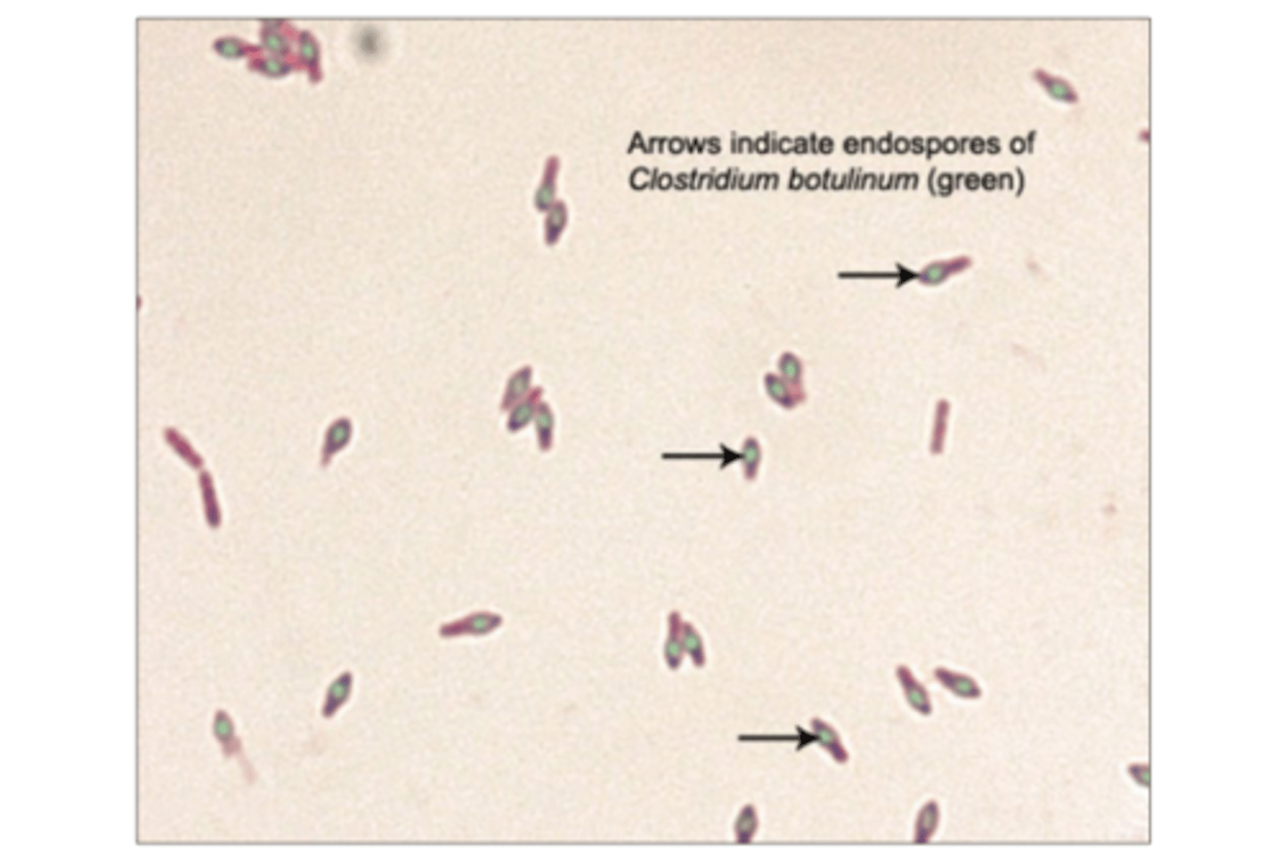 <p>Gram-positive bacilli</p><p>Anaerobic and causes endospores</p>