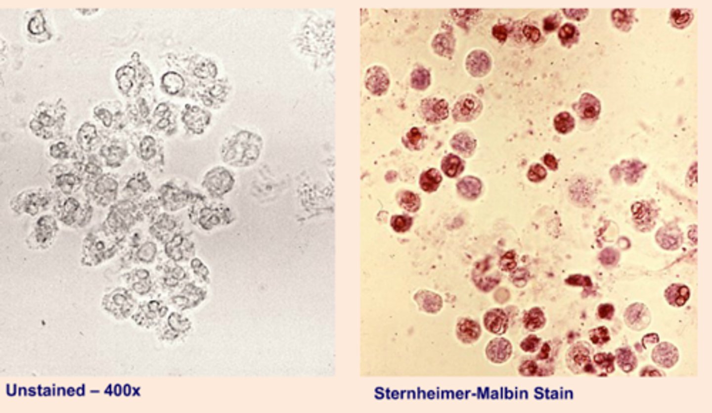 <p>Delineates structure and contrasting colors of the nucleus and cytoplasm. (Identifies WBCs, epithelial cells, and casts)</p>