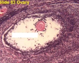 mature or atretic follicle? why?