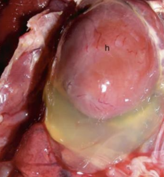 <p>What is the term for general edema in the heart, due to CHF, ascites syndrome in poultry, renal failure, or hypoproteinemia?</p>