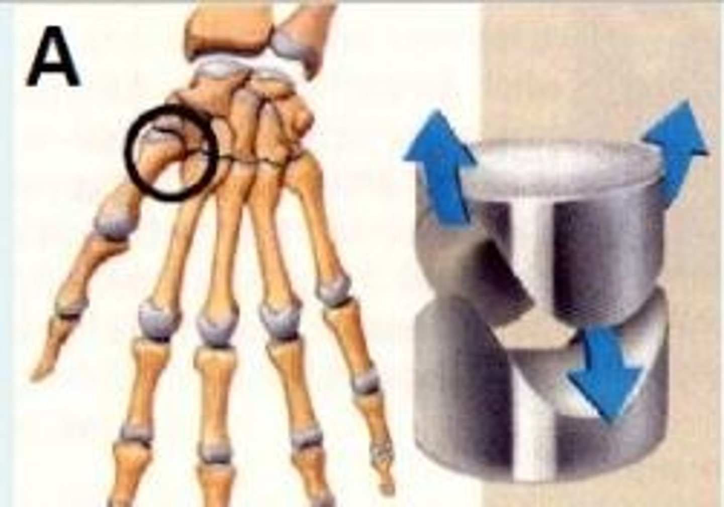 <p>Architecturally; how do you classify the synovial joint shown in image A.</p>