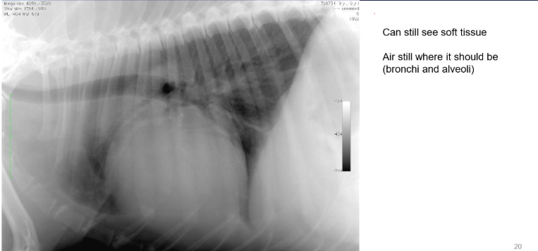 <ul><li><p>can still see soft tissue</p></li><li><p>air still where it should be (bronchi and alveoli)</p></li><li><p>can see cardiac silhouette</p></li></ul><p></p>