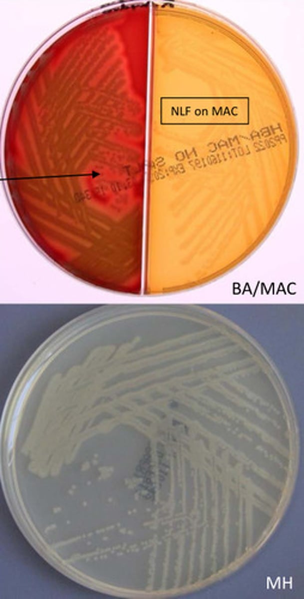 <p>GNB, motile, cat pos, oxidase neg, resistant to O10ug and 150ug disc, indole pos, DNAse pos, grows on CIN agar</p>