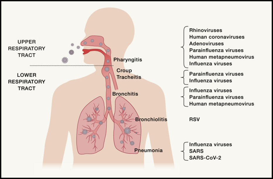 covid infects lower lungs