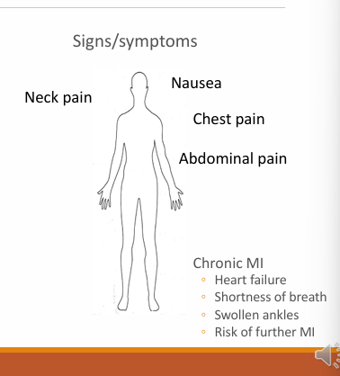 <ul><li><p>neck pain</p></li><li><p>nausea</p></li><li><p>chest pain</p></li><li><p>abdominal pain</p></li></ul><p></p>
