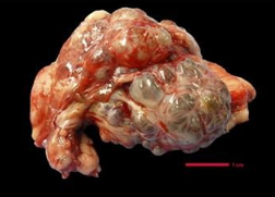 <p>Usually secondary to bile duct irritation and hyperplasia - Eimeria stiedae</p><p>Often incidental finding on ultrasound or PM</p><p>Could surgically remove if solitary mass</p>