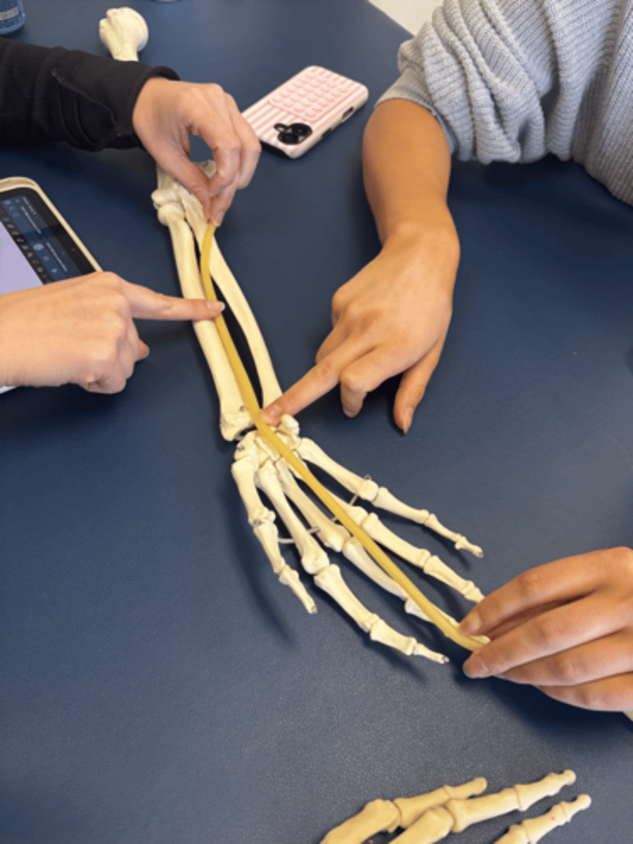 <p>What is this muscle?</p>