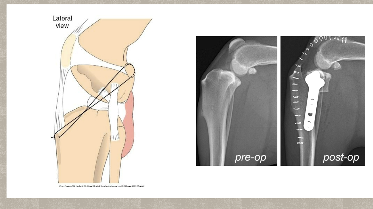 <p>Is considered the gold standard</p><p>Intracapsular</p><p>extracapsular</p><p>TPLO</p>