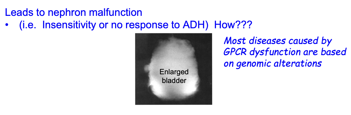 <ul><li><p>Caused by mutations in the ADH receptor (GPCR) — X-linked recessive inheritance</p></li><li><p>Mainly affects males; females are carriers</p></li><li><p>Symptoms: excessive thirst, large volume of hypotonic/dilute urine (&gt;3L/day, &lt;250 mmol/kg)</p></li><li><p>Leads to dehydration, fatigue, seizures due to electrolyte imbalance, enlarged bladder</p></li><li><p>Nephrons are insensitive to ADH → impaired water reabsorption</p></li></ul><p></p>