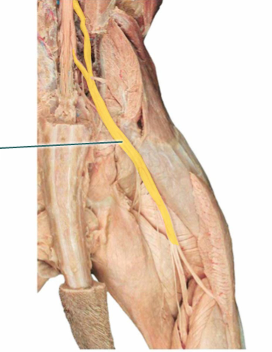 <p>What is the name of the yellow highlighted nerve?</p>