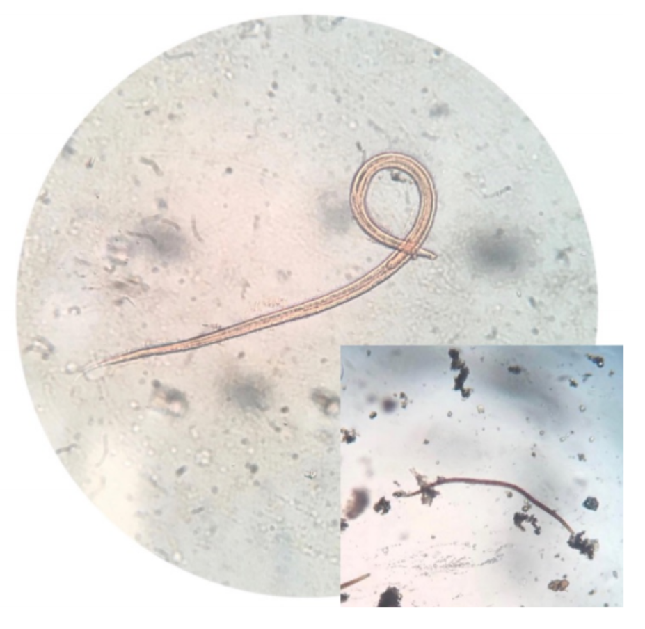 <p>Sobre o(s) parasito(s) na foto, escreva:</p><ul><li><p><strong>NOME CIENTÍFICO</strong></p></li><li><p><strong>FORMA EVOLUTIVA</strong> (+ <strong>SEXO</strong> - <u>se houver</u>)</p></li></ul>