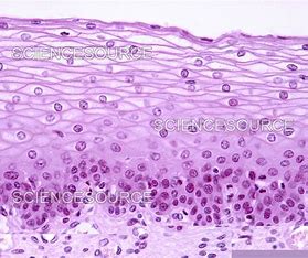 <p>Subcategories of Epithelium: Shape - Squamous</p>