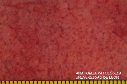 <p>Neumonía intersticial. Maedi. Ovino.</p>