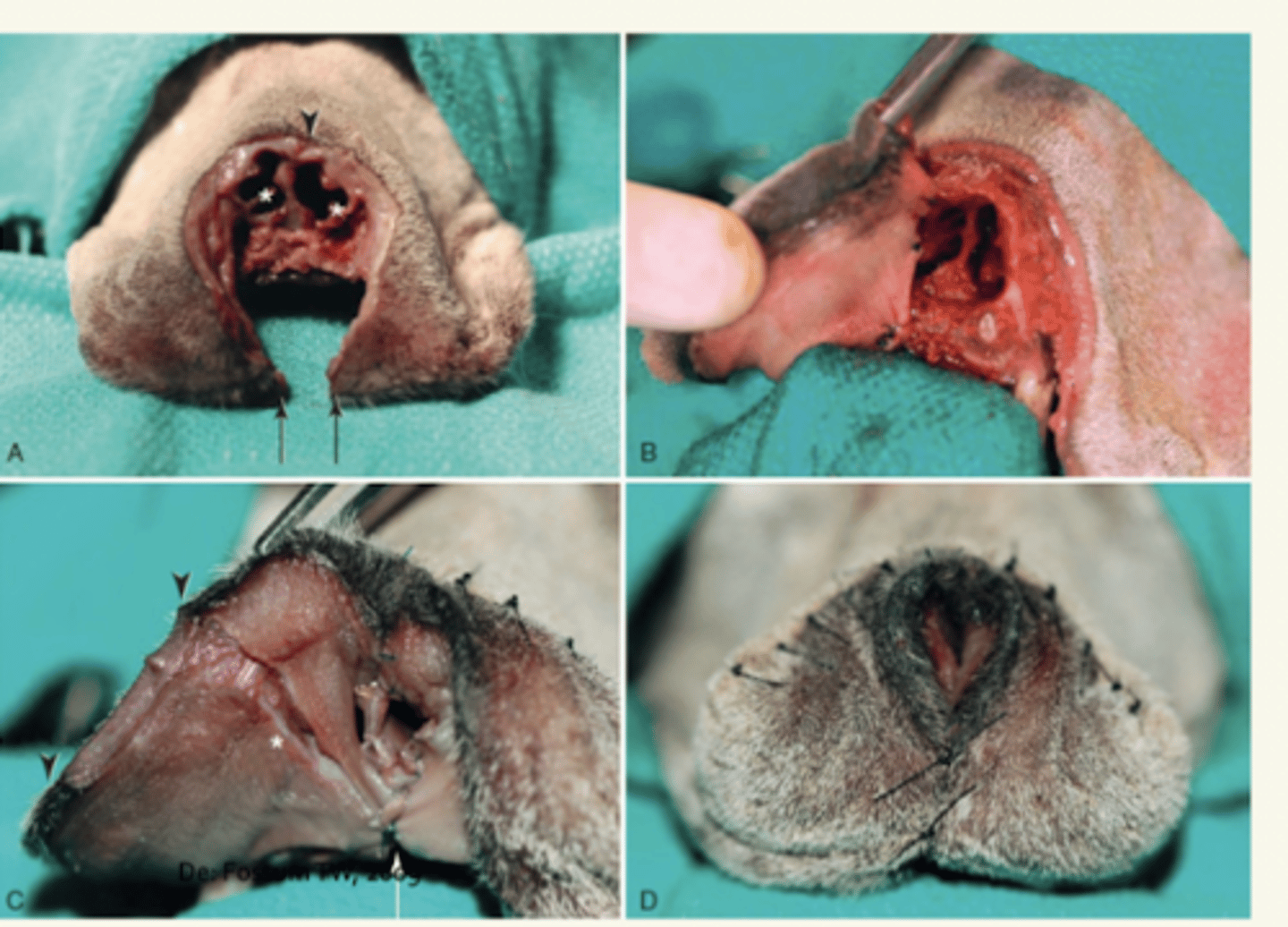 <p>1. incisión cutáneo en círculo</p><p>2. exéresis del los cartílagos y cornetes</p><p>3. sutura muco-cutánea, mucosa oral, unión labial</p>