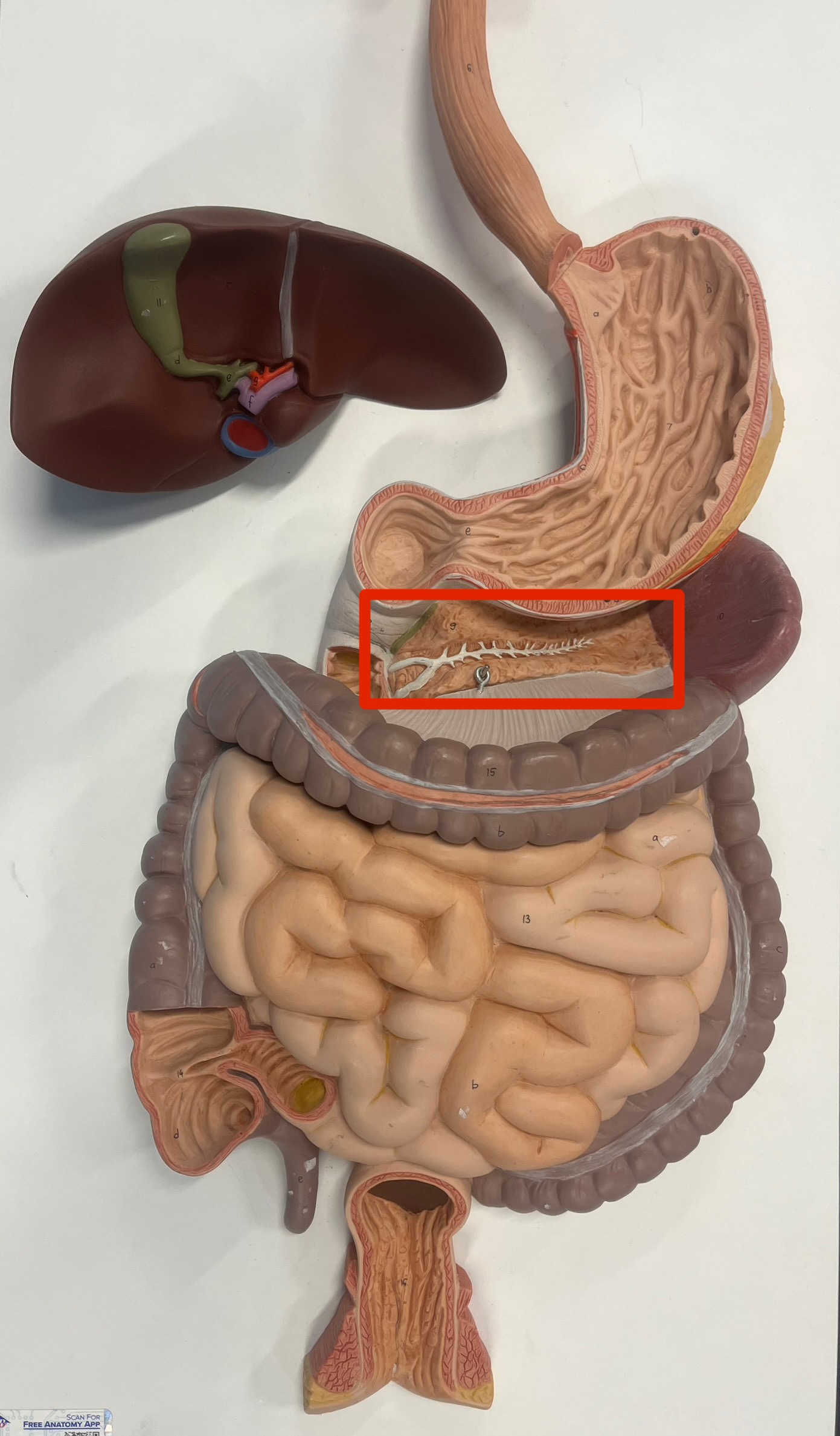 <p>what is the white portion in the pancreas?</p>