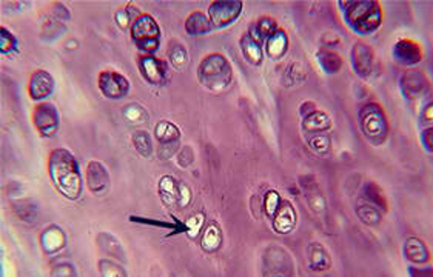 <p>(cartilage cells) occupy small chambers called lacunae and are surrounded by extracellular matrix containing very fine collagenous fibers.</p>