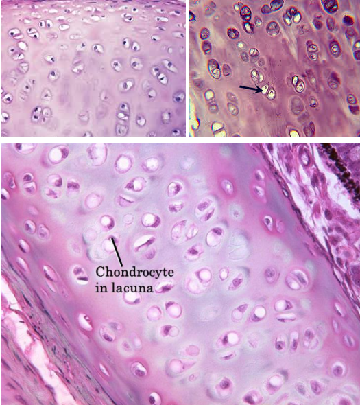 <p><strong>Hyaline cartilage connective tissue</strong></p>