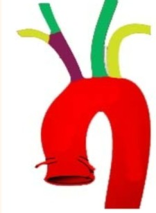 <p>Label which what structure/artery represents each color.</p><ol><li><p>What are the names of the small red arteries that branching off?</p></li></ol><p></p>