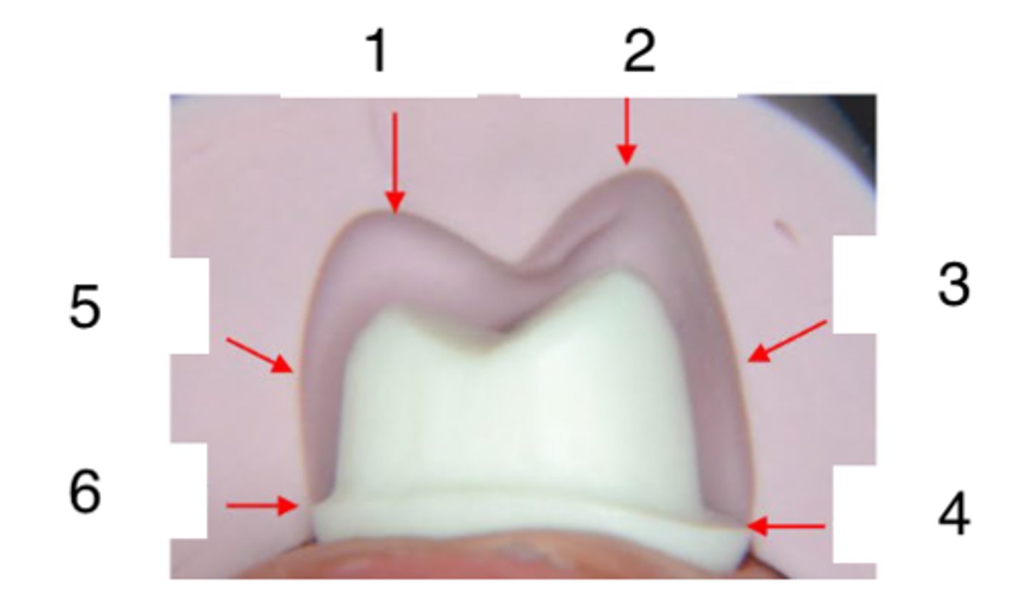 <p>What is the measurement of 5?</p>