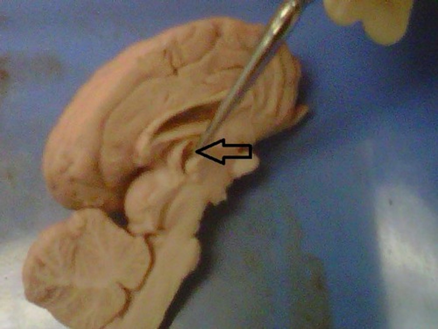 <p>Canals in the interior of the brain that are filled with CSF or cerebral spinal fluid which cushions and protects the brain.</p>