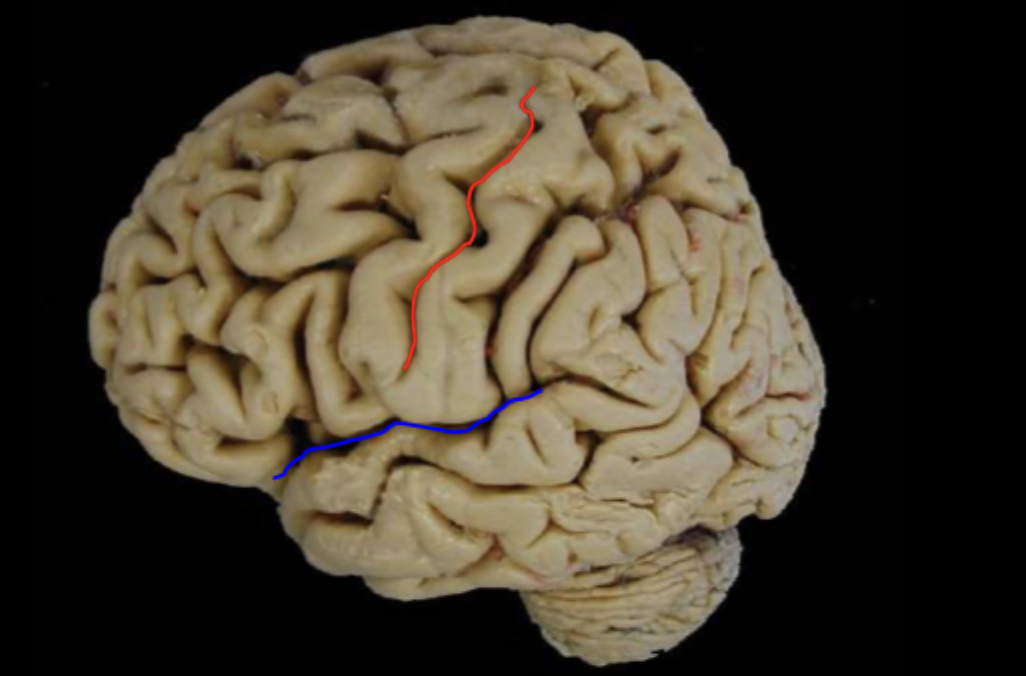 <p>What sulcus fissure/sulcus is labeled in red and blue?</p>