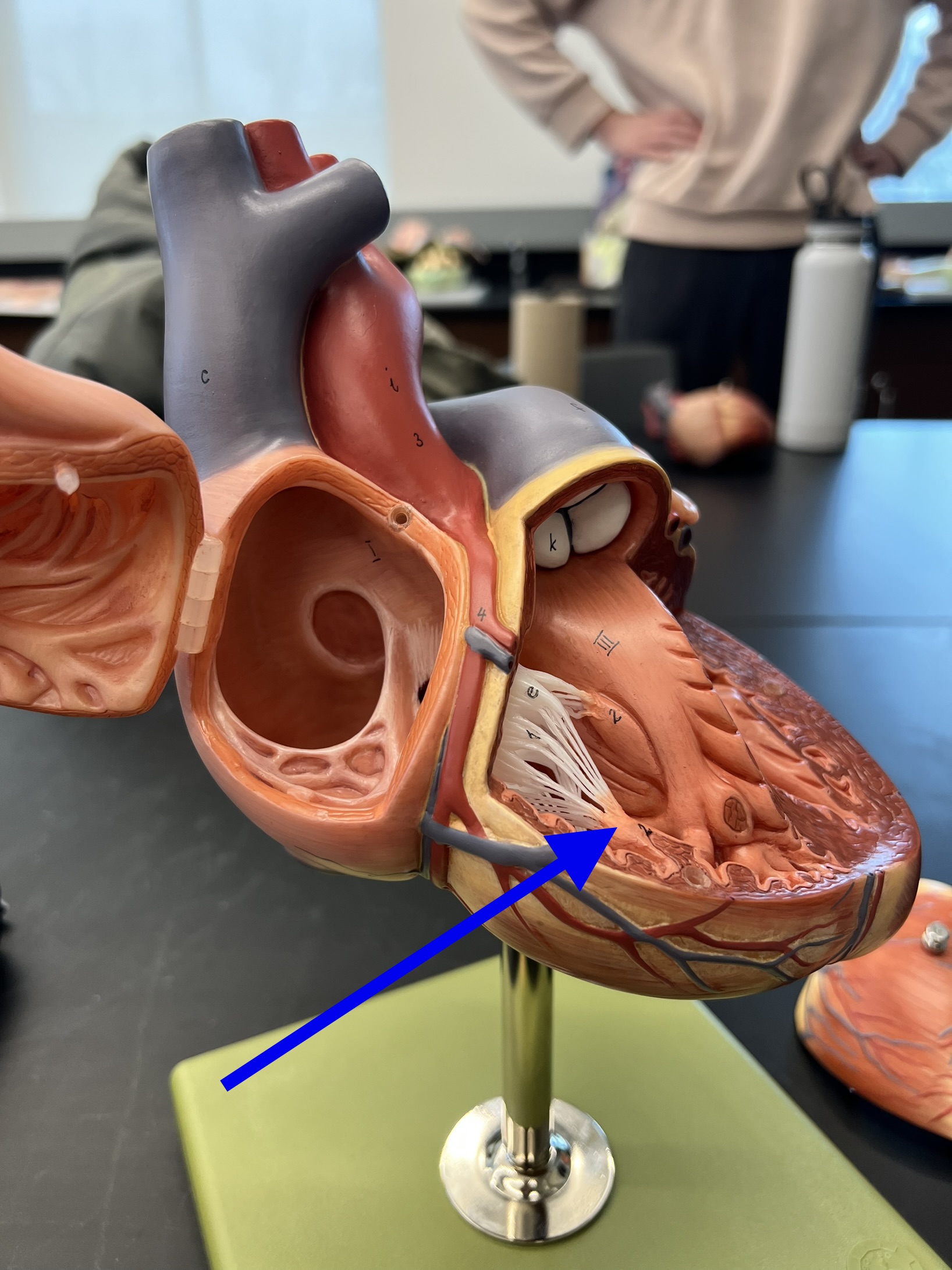 Name the heart structure.