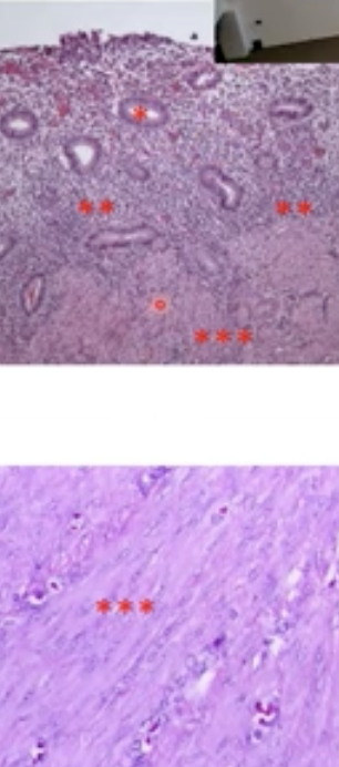 Endometrium / Mucosa : Glandular structures (one dot) and stroma (two)  

Myometrium : S. muscle tissue (three)  

Serosa : mesothelial lining on the outside of the uterus 